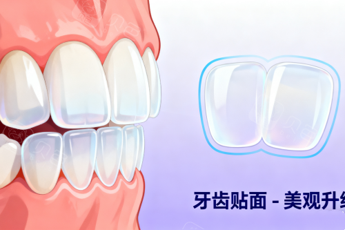 牙齿贴面美白牙齿卡通图