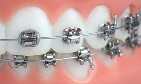 牙科全景机怎么复位重庆秀山牙康口腔医院怎么样？医生经验足、技术好，拔牙补牙几乎不疼_https://www.jmylbn.com_新闻资讯_第8张