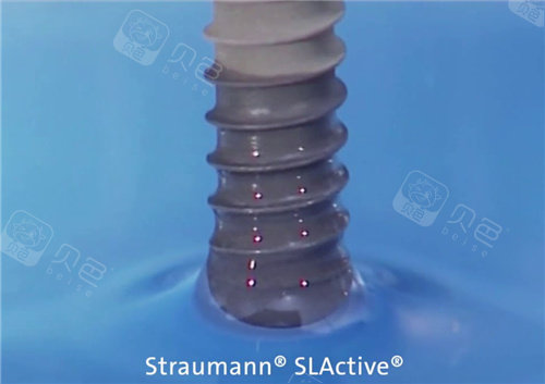 瑞士士卓曼iti亲水型种植牙