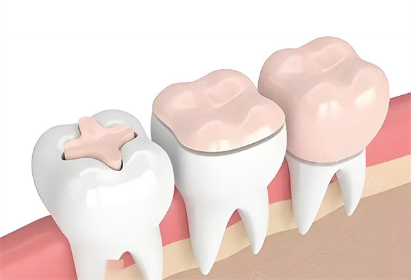 泌阳县华瑞口腔怎么样？基础诊疗+正畸种牙，泌阳本地看牙口碑佳