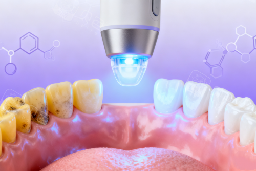 牙齿美白修复卡通展示图