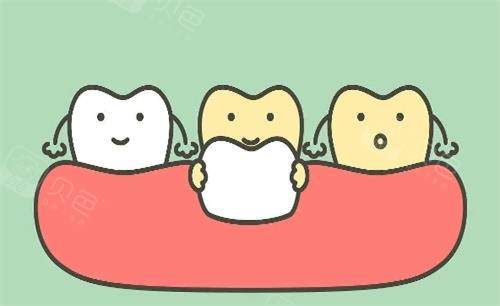 瓷贴面美白牙齿动画展示图