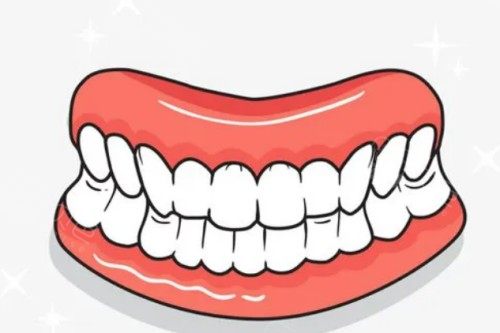 坪山区马峦看牙好的医院是哪家？本地人私藏的私立牙科清单来了！