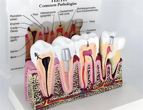 荥阳人民医院牙科怎么样？技术成熟服务贴心|满足全年龄段护牙需求！