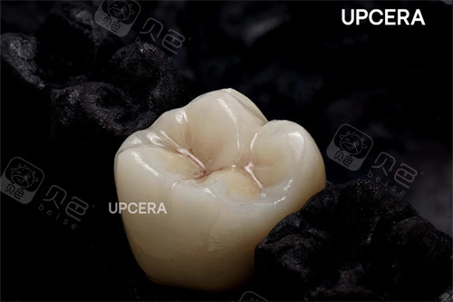 邯郸做全瓷牙哪家牙科比较好，壹颗芽口腔/中科口腔/牙e生口腔等技术好！