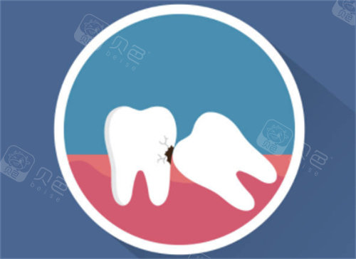 黄石哪个医院牙科比较好？中山口腔、咿呀口腔等4家正规机构上榜！