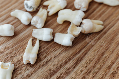 牙齿模型宣传图