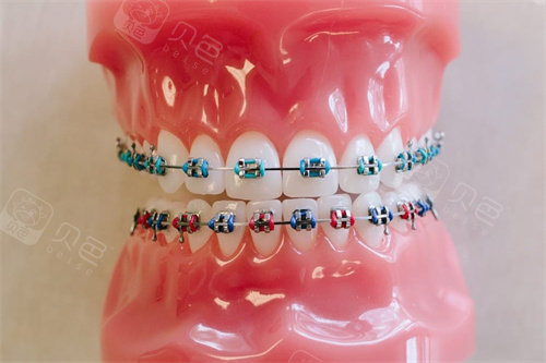临海市牙齿矫正哪家医院好？麦尔/许捷/蒋颂瑶/黄伟口腔优势对比!