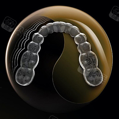 时代天使angelalign隐形矫治器怎么样？适用人群/佩戴体验/病例