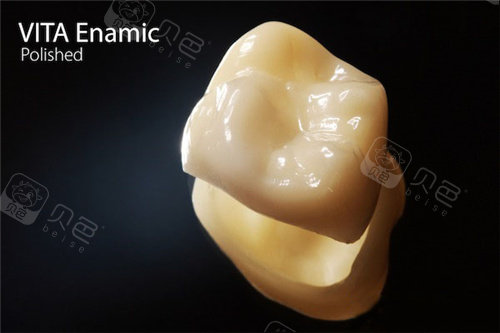vita全瓷牙