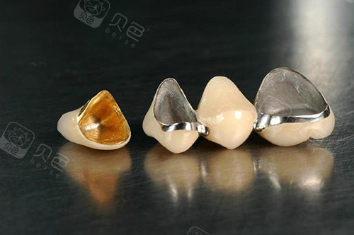 全瓷牙冠材料展示