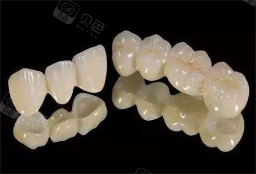 亲测推荐新余全瓷牙排名前五名单：现代/尚恩/新奥/郭军永/杨婷口腔！