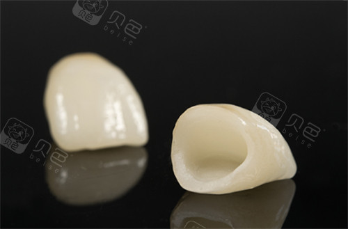 亲测推荐新余全瓷牙排名前五名单：现代/尚恩/新奥/郭军永/杨婷口腔！