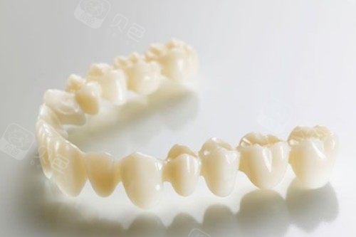 全瓷牙冠卡通图片展示