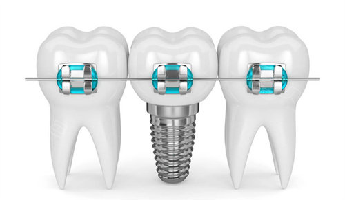 重庆东南医院口腔科2026新价格！补牙120元起，洗牙58元起！
