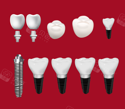 贝壳口腔是正规医院吗?贝壳口腔医院怎么样？属于中高端档次正规连锁牙科！