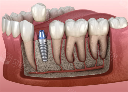 贝壳口腔是正规医院吗?贝壳口腔医院怎么样？属于中高端档次正规连锁牙科！