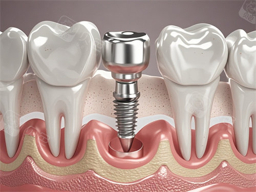 网选重庆奉节牙科医院排名榜:奉节爱牙仕口腔、欧菲雅创美口腔种牙正畸好！