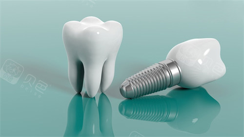 种植牙植体和牙冠漫画示意图