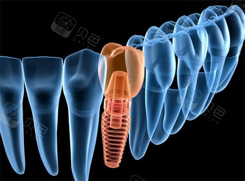 张家港鼎植口腔怎么样?是正规医院吗?怎么预约?地址在哪?收费贵吗?