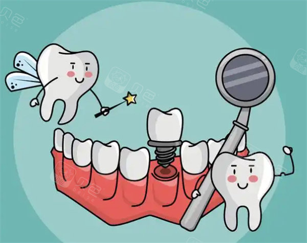 口腔种植手术包怎么打乌兰察布牙科机构收费标准2026：含种植牙、洗牙及补牙本地行情价一览_https://www.jmylbn.com_新闻资讯_第4张