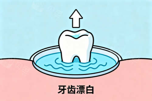 牙齿漂白卡通图