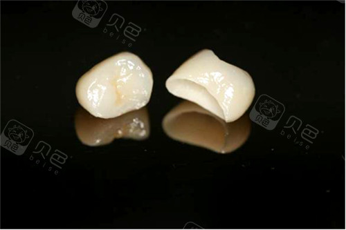 两颗全瓷牙冠实物图