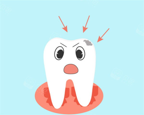 补牙卡通图片展示