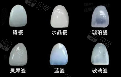 牙贴面材料