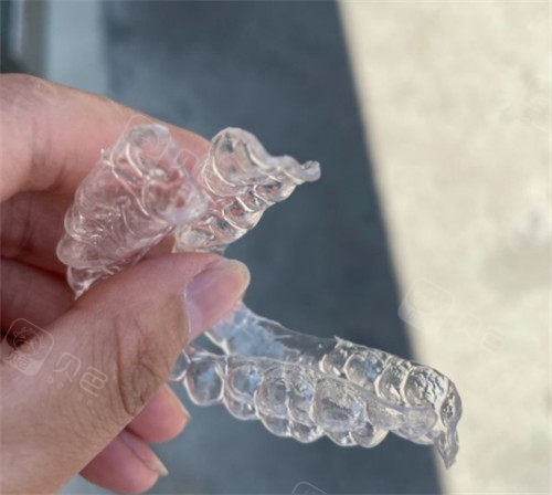 国产隐形牙套照片