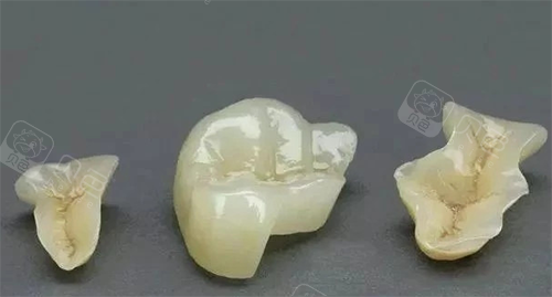牙齿修复材料图