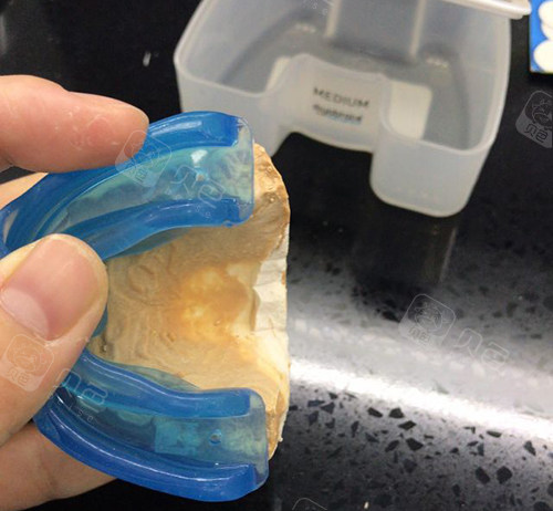 牙齿矫正MRC早期肌功能矫正器石膏模型试戴.jpg