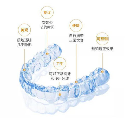 时代天使矫正多少钱，汇总常规定价区间，不同版本收费标准一目了然！ - 沃牙网