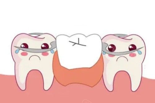 活动假牙安装卡通图