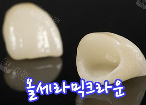 牙冠改善照片图