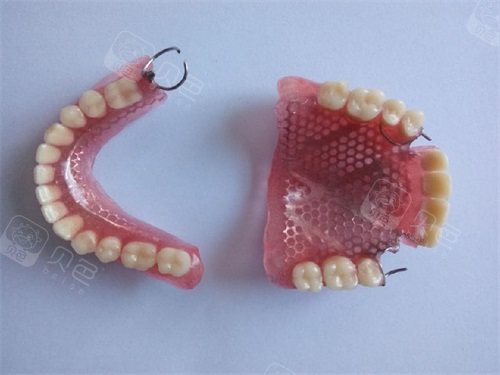 普通全口义齿假牙实物图.jpg