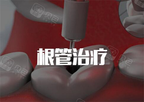 根管治疗卡通图.jpg
