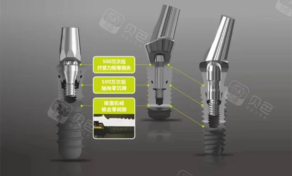 百康特种植牙怎么样.png