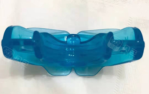 牙齿矫正MRC早期肌功能矫正器5.jpg
