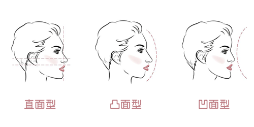 牙齿矫正面型问题.png