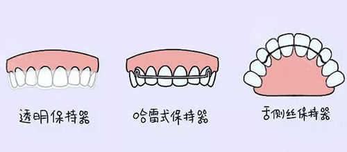 牙齿矫正正畸保持器漫画图.jpg