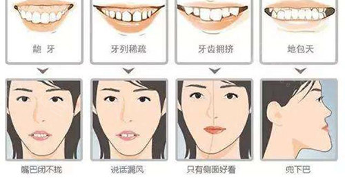 牙齿矫正脸型变化适应症.jpg