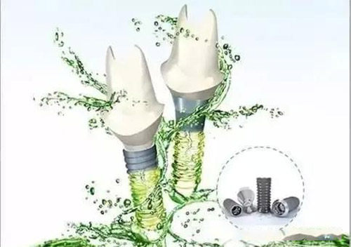 亲水性种植牙基台照片.jpg