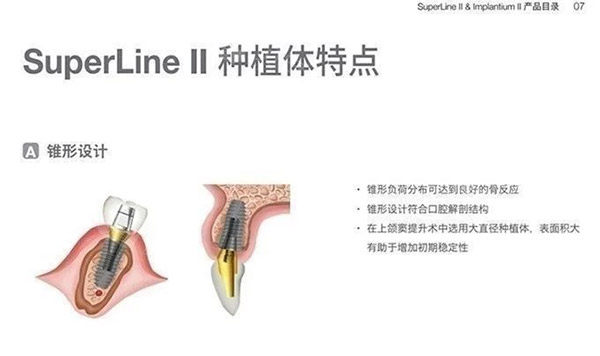 登腾二代种植体特色图片.jpg