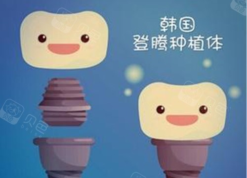 登腾种植体.jpg
