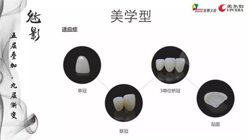爱尔创全瓷牙魅影美学型适应症.jpg