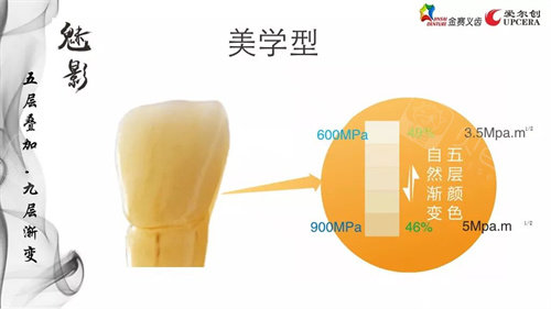 爱尔创全瓷牙魅影美学型.jpg