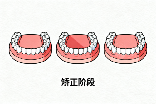 牙齿矫正成果展示.png