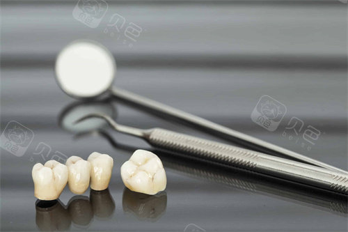 牙齿检查工具和牙冠