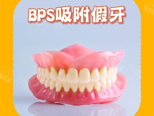 BPS吸附性义齿模型图.jpg